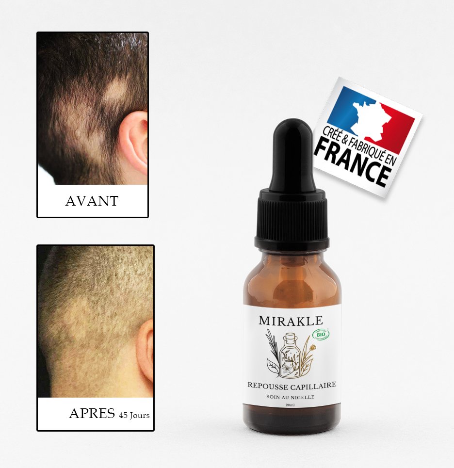 repousse capillaire naturel mirakle nigelle
